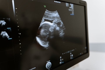 Firasat Ibu tentang Jenis Kelamin Bayi, Mitos atau Fakta?