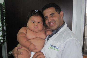 Bayi 10 Bulan Memiliki Berat Badan 20 Kg
