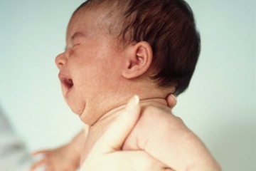 Bayi Lebih Sensitif Terhadap Rasa Sakit