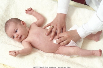 Jenis Hernia Pada Bayi
