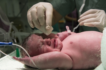 Waspada Asfiksia, Bayi Baru Lahir Kekurangan Oksigen