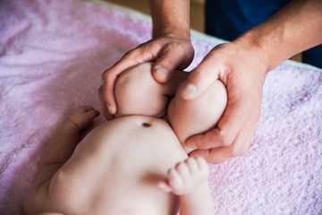 Waspada Hipospadia, Kelainan Kelamin pada Bayi Laki-laki