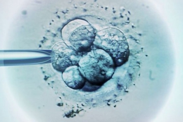 Tes DNA Tingkatkan Keberhasilan IVF