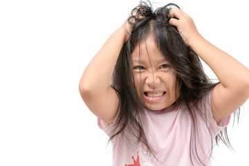Cara Aman & Tepat untuk Mengatasi Ketombe pada Anak