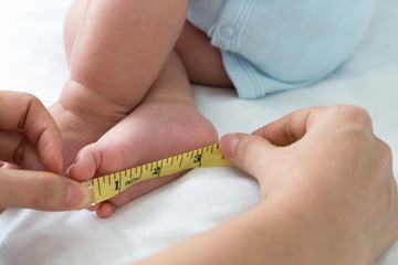 Dwarfisme Bukan Stunting! Ini Perbedaannya