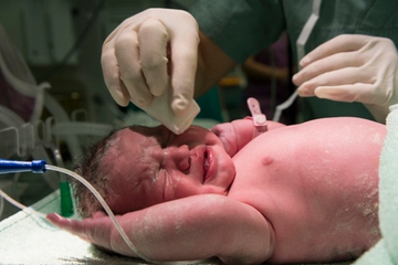 Mengenal Vernix Caseosa, Selimut Alami Bayi Baru Lahir