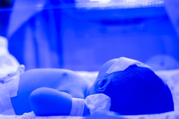 Bayi Kuning, Cukup Dijemur Saja atau Harus Dirawat?