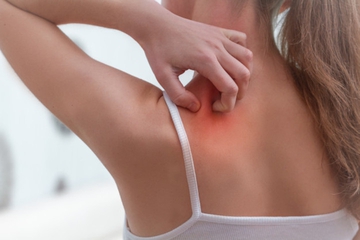Psoriasis saat Hamil, Adakah Dampaknya pada Janin?