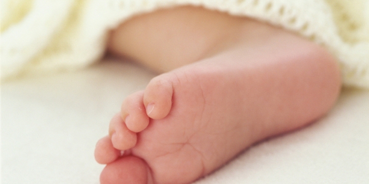 Selulitis pada Bayi