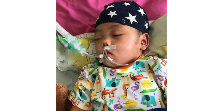 Kisah Bayi Gibran yang Koma karena Encephalitis