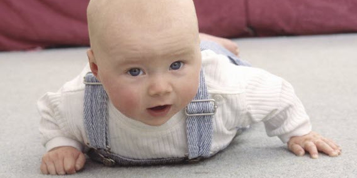Mengenal Cerebral Palsy pada Bayi