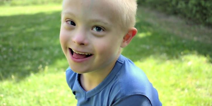 10 Fakta Down Syndrome pada Balita