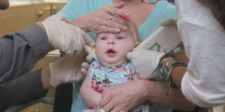 Hati-Hati, Tindik Telinga Bayi Berisiko Infeksi!