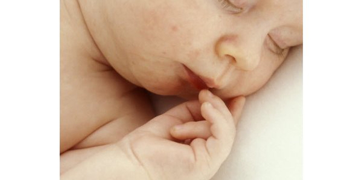 Bayi Dicurigai Kelainan Jantung karena Kuku Jarinya Membiru
