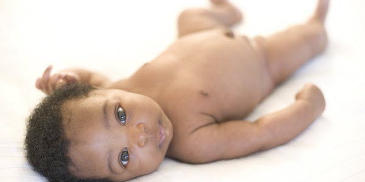 Sunat bagi Bayi