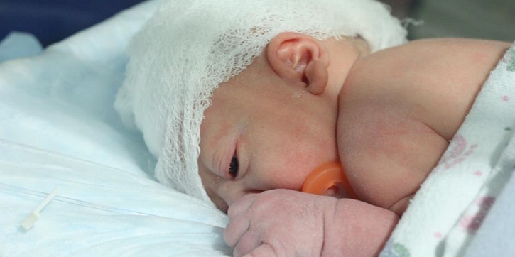 Bayi dengan Kelainan Tabung Saraf Mampu Bertahan Hidup