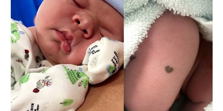 Unik! Bayi Ini Memiliki Tanda Lahir Berbentuk Hati