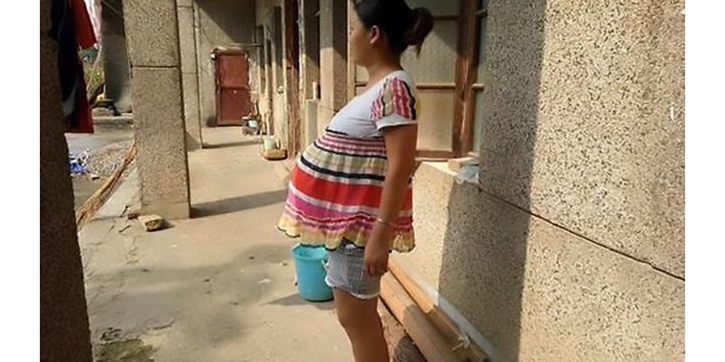 Wanita Ini Hamil selama 17 Bulan