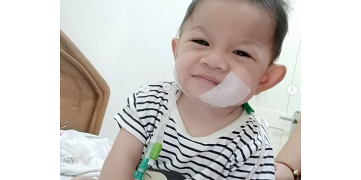 Perjuangan Baby Kenzie yang Terlahir Tanpa Anus