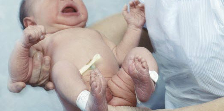 Waspada Hipotiroid pada Bayi
