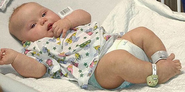 Bayi Selamat Berkat Blitz Kamera