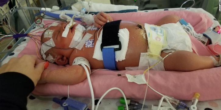 Tragis! Bayi Meninggal karena Dicium Orang Lain