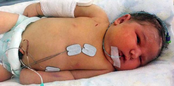Bayi Dipatahkan Tangannya Agar Bisa Dilahirkan