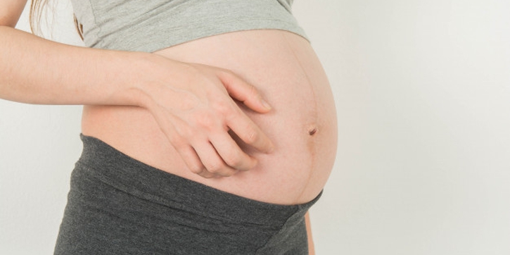 Mengenal Kolestasis, Gatal Berlebih saat Hamil