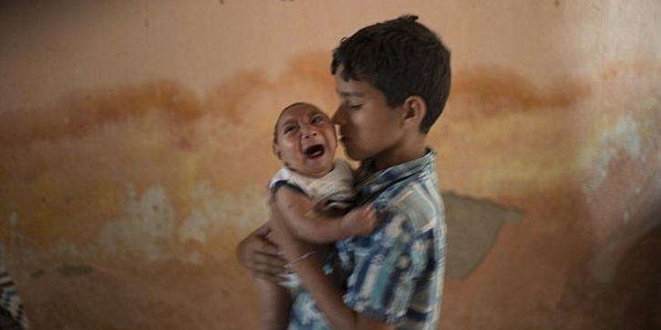 Virus Zika Sebabkan Bayi Lahir Berkepala Kecil