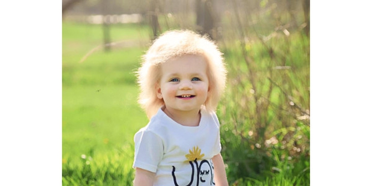 Bayi Ini Punya Rambut ‘Jabrik’ Langka