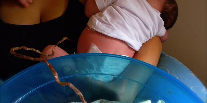 Pro dan Kontra Lotus Birth