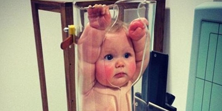 Bayi Sedang X-Ray Undang Tawa Pengguna Internet