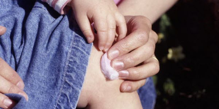 Penanganan Perdarahan Luar Pada Anak Hemofilia
