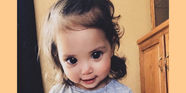 Bermata Indah, Bayi Ini Ternyata Idap Penyakit Langka