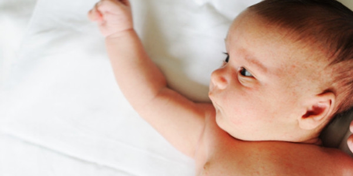 Moms, Kenali Jenis Ruam Kulit Bayi
