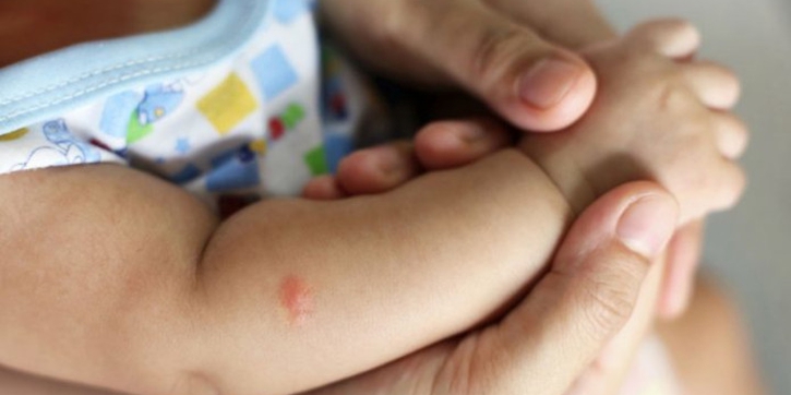 Bisul pada Bayi, Ini Penyebab dan Cara Mengatasinya