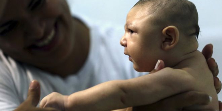 Virus Zika Sebabkan Kelainan Mata pada Bayi