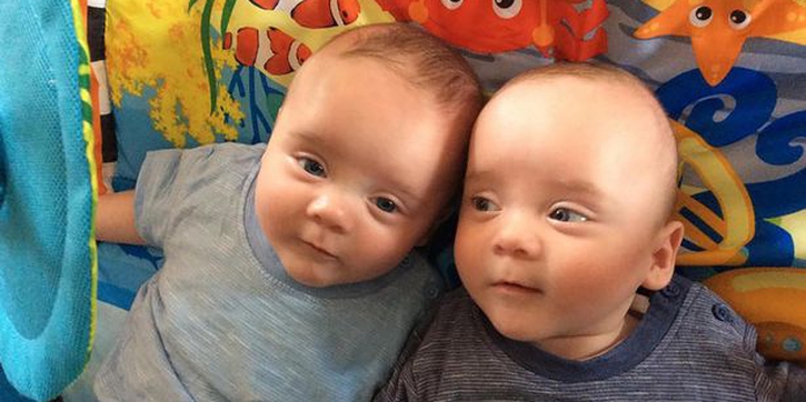 Si Kembar dengan Twin to Twin Transfusion Syndrome