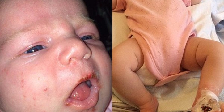 Hati-Hati Jika Orang Lain Mencium Bayi Anda! 