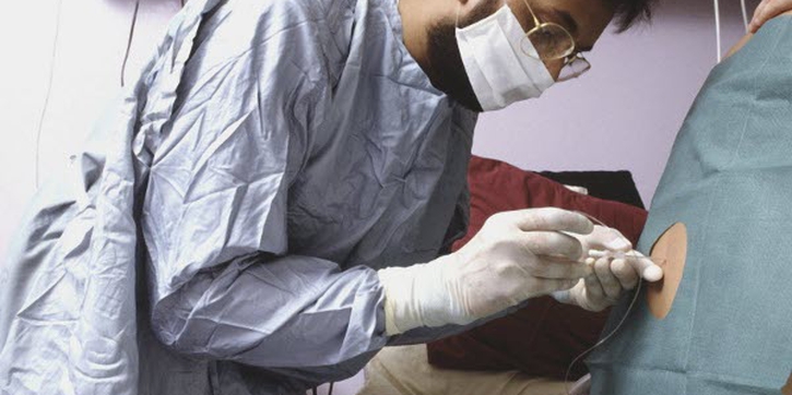 Mengenal Epidural