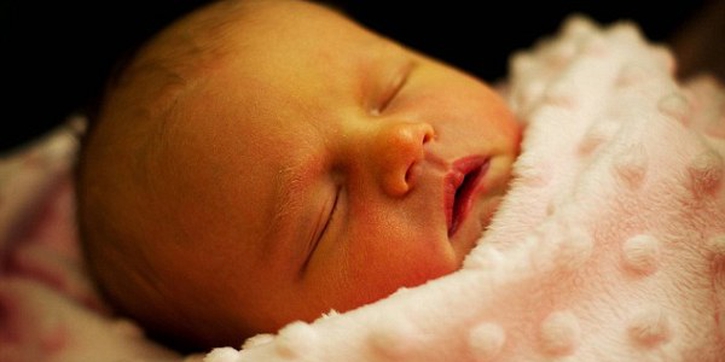 Waspadai Tanda Lahir di Kulit Bayi Anda!