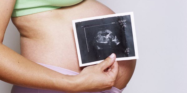 Diagnosa Placenta Accreta (2) 