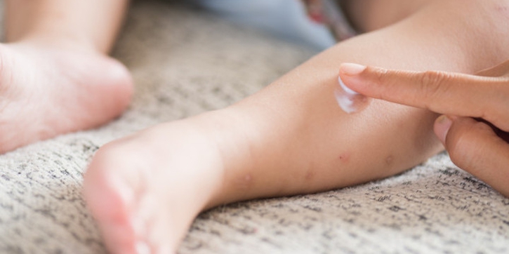 Campak pada Bayi, Kenali Gejala dan Penanganannya, Moms