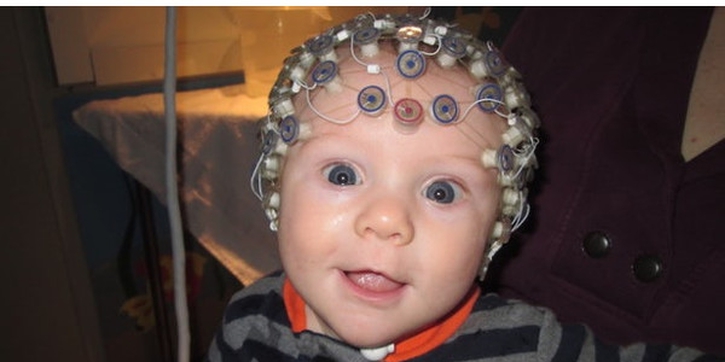 Diagnosis Autisme Sejak Dini dengan EEG Sederhana