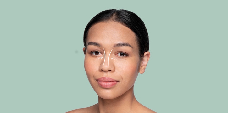 Jangan Tergiur Hasilnya, Kenali Dulu Risiko Tanam Benang Hidung