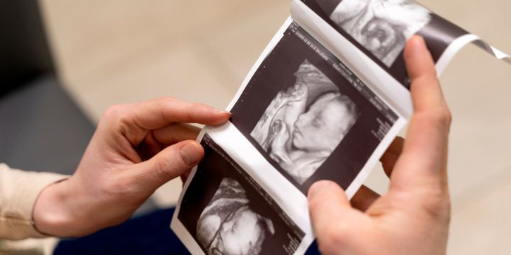 Periksakan Secara Teratur, Ini 7 Tanda Janin Sehat Trimester 1