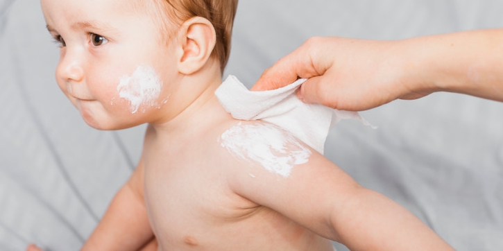 10 Obat Biang Keringat pada Bayi yang Aman dan Efektif