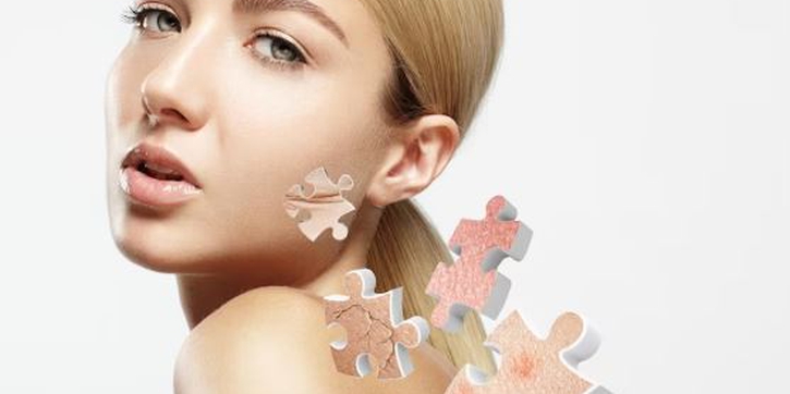 Tips Merawat dan Mengatasi Masalah Kulit Kering pada Wajah