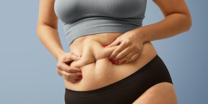 Mengenal Diastasis Recti, Kondisi Perut Usai Melahirkan yang Jarang Diketahui Ibu