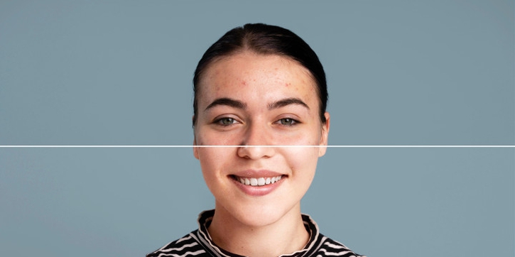 Cara Mudah untuk Mengetahui Jenis Kulit Wajah Anda